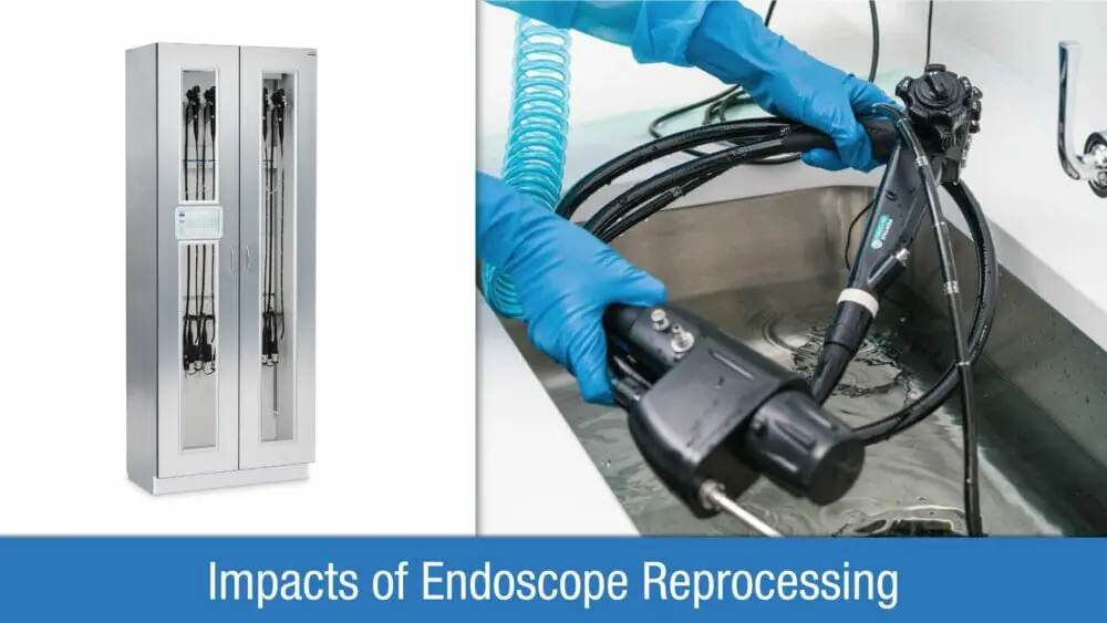 A stainless steel medical scope cabinet, a close up of a nurse with gloves rinsing a scope in an industrial stainless sink, and the words "Impacts of Endoscope Reprocessing"